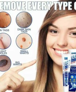Wart Skin Tag Removal Ointment