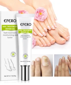 Fungal Nail Treatment Serum Nail Foot Nail Fungus Removal Gel Anti Infection Onychomycosis Nail Repair Essence Cream Feet Care