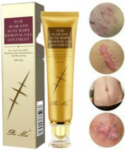 Acne Scar Removal Treatment Cream