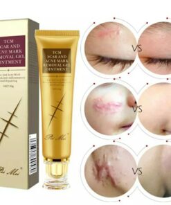 Acne Scar Removal Treatment Cream