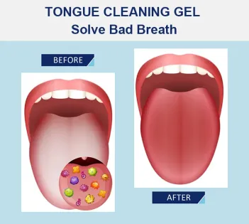 FEATURES 👅Tongue Cleaning Gel & Brush🍀 