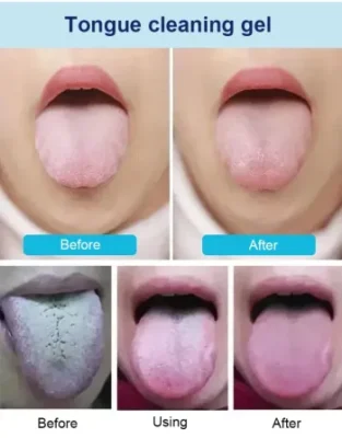 NEVER FEEL ANXIOUS ABOUT BAD BREATH AGAIN: Fact: you can’t smell your own breath. Don’t get caught not knowing! If you ever have lingering doubts about the freshness of your breath, The Original Brush and Gel will give you complete confidence. Be confident knowing that has your back. Brush your tongue for confidence. In just ten seconds, you can remove the odor-causing microbes in your mouth and feel fresher than ever